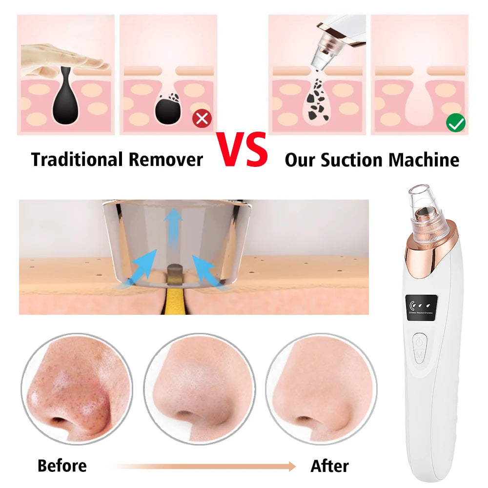 Appareil de beauté nettoyant pour le visage