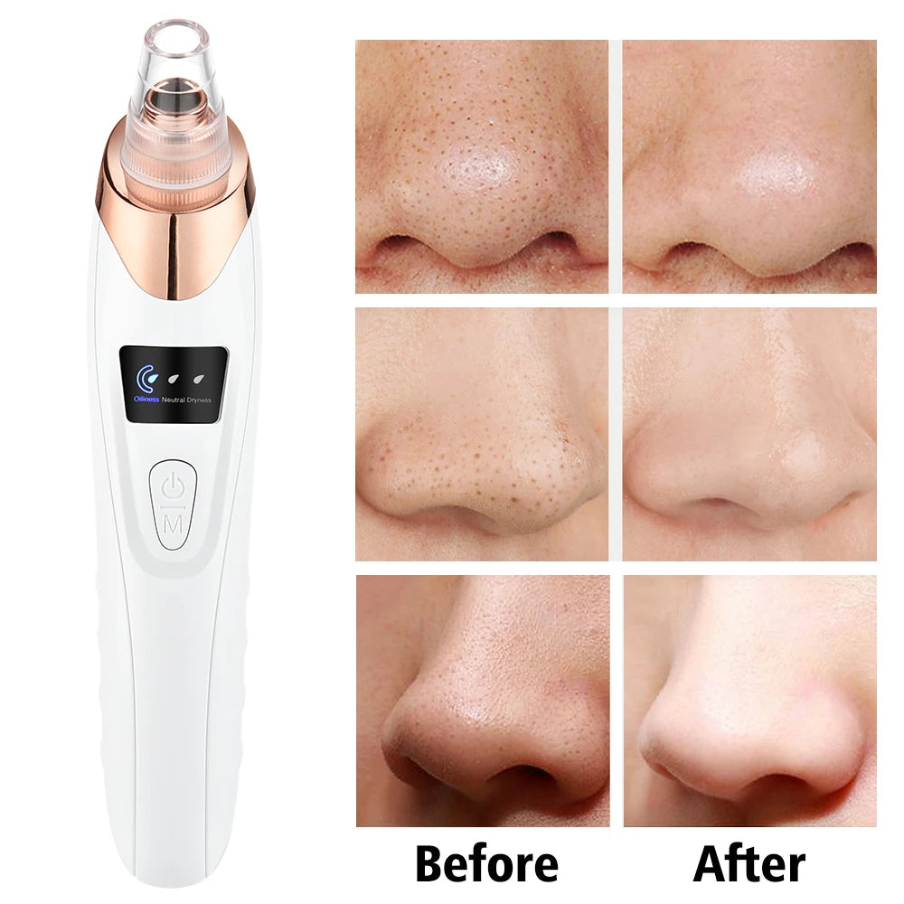 Appareil de beauté nettoyant pour le visage